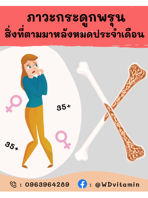 ภาวะกระดูกพรุน (Osteoporosis)