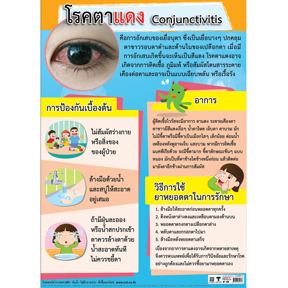 Conjunctivitis (Pinkeye) Educational Poster No.479
