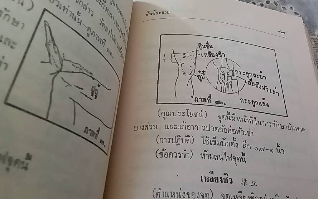 วิชาการปักเข็มรักษาโรค ภาคปฏิบัติเบื้องต้น