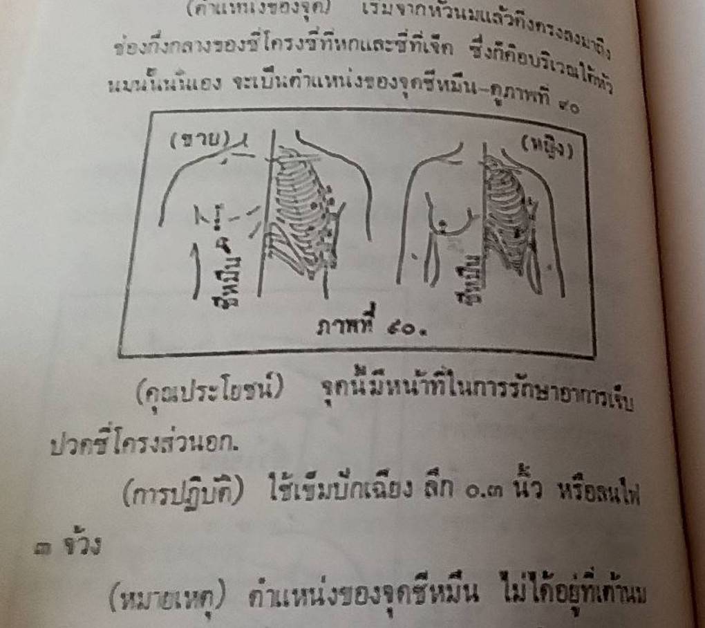 วิชาการปักเข็มรักษาโรค ภาคปฏิบัติเบื้องต้น