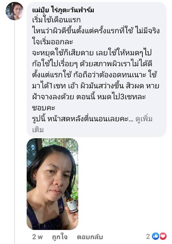 Y8 พันทิป สิวผด ฝ้าจาง