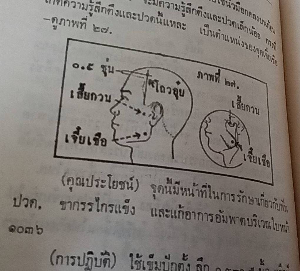 วิชาการปักเข็มรักษาโรค ภาคปฏิบัติเบื้องต้น