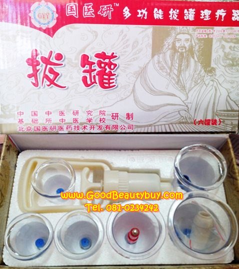 ชุดครอบแก้วสุญญากาศ ถ้วยดูดสุญญากาศ Chinese cupping Kit (6pcs)
