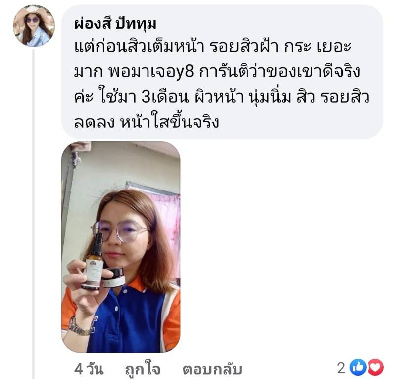 Y8 พันทิป สิวเต็มหน้า รอยสิวฝ้า กระ