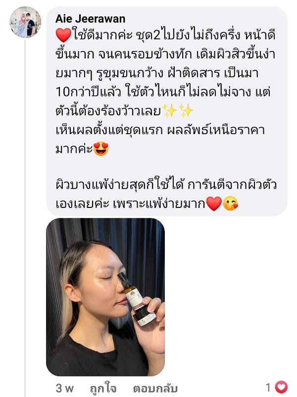 Y8 ดีจริงไหม ฝ้าติดสารเป็นมากว่า 10ปี