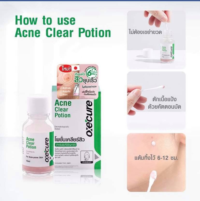 (ซื้อ3 ราคาพิเศษ) OxeCure Acne Clear Potion อ๊อกซีเคียว 15ml.