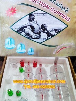 ชุดครอบแก้วสุญญากาศ ถ้วยดูดสุญญากาศ ABC Chinese suction cupping Kit (18pcs)