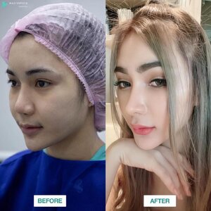คลีนิกเสริมจมูก โทร 095-5266242 เสริมหน้าอก เสริมจมูก ทำตา2ชั้น สำหรับผู้หญิงเรา ต้องสวย เพราะความสวยจะเปลี่ยนชีวิต