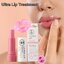 Ultra Lip Treatment อัลตรา ลิป ทรีทเมนต์ ตรา เภสัชกร เนื้อลิปให้สีชมพู กลิ่นแครนเบอรี่ ขนาด 4.5 กรัม